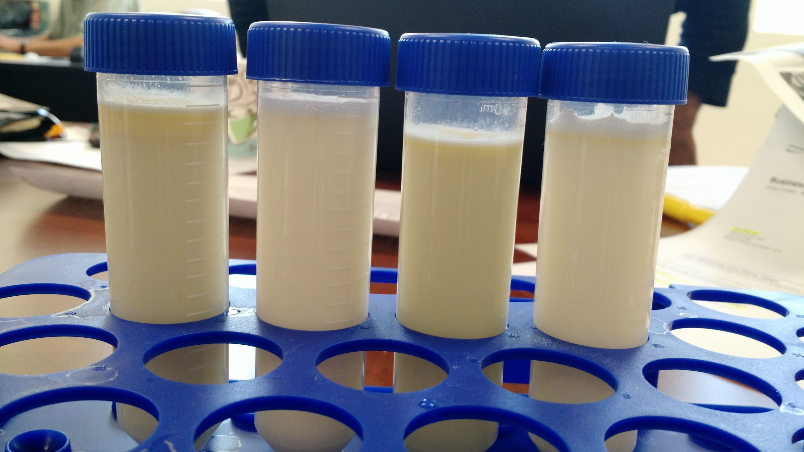 vials of cultured milk in lab