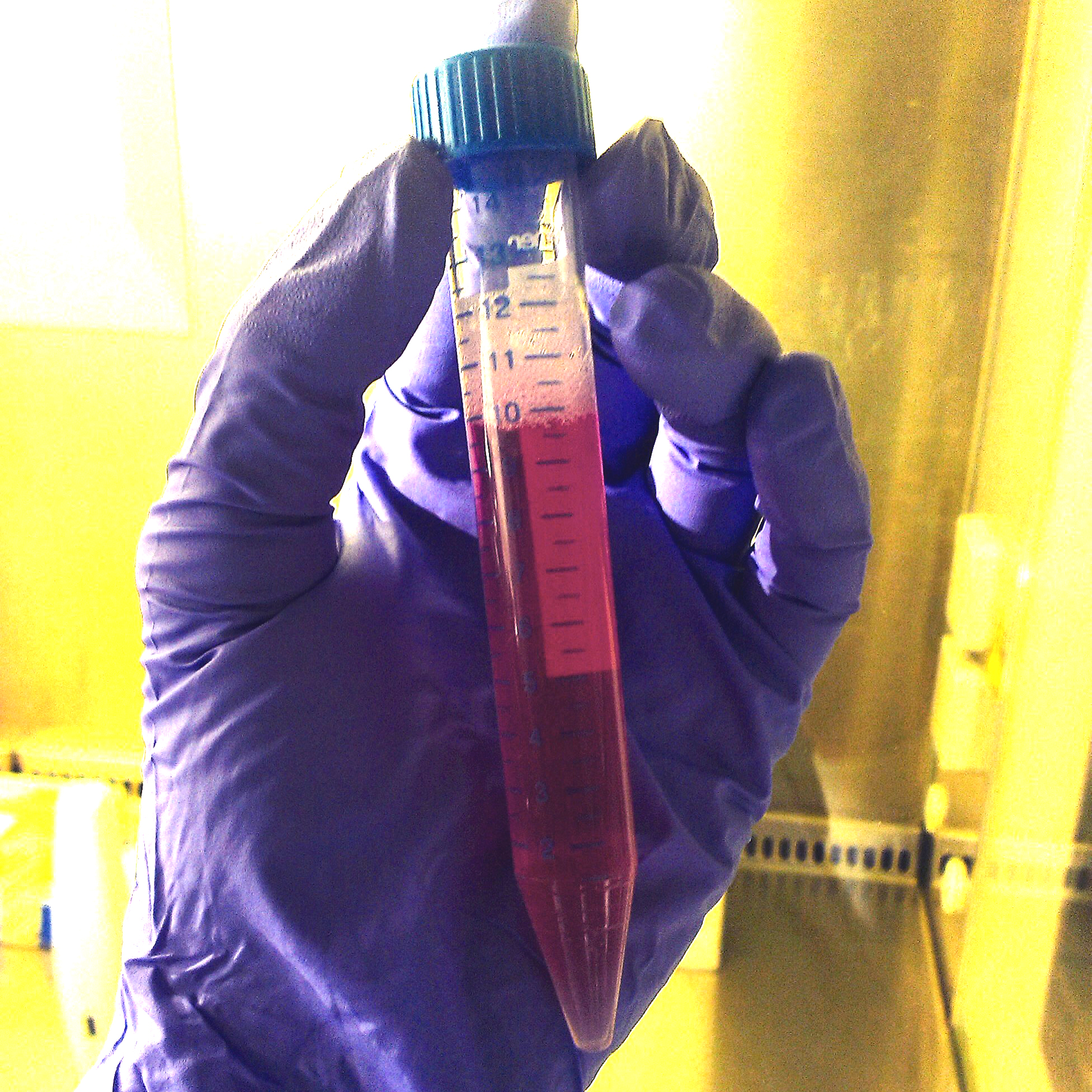 growth medium in test tube