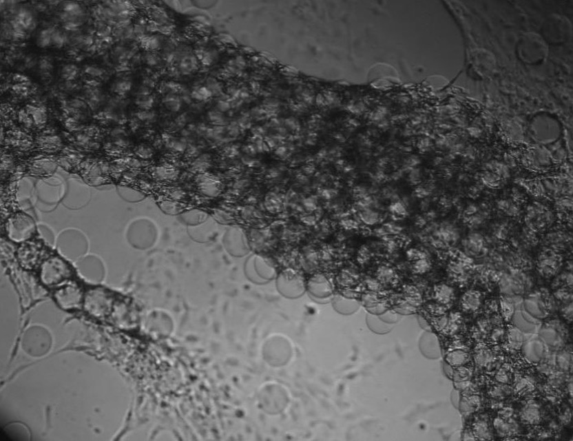 fat cells on microparticle scaffold