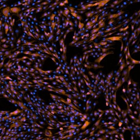 Fluorescent-stained C2C12 cell micrograph obtained using the BioTek Cytation1 Ted was demoing in his lab.