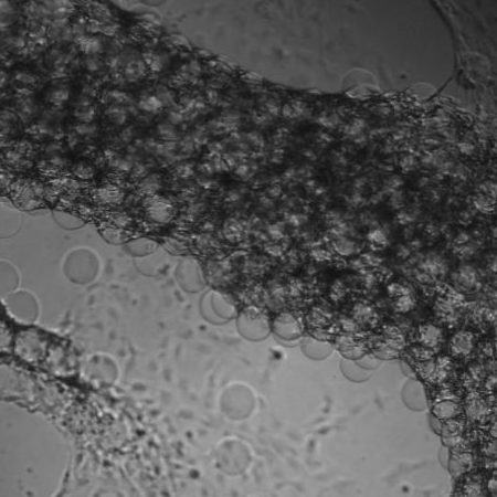 Fat cells on microparticle scaffolds